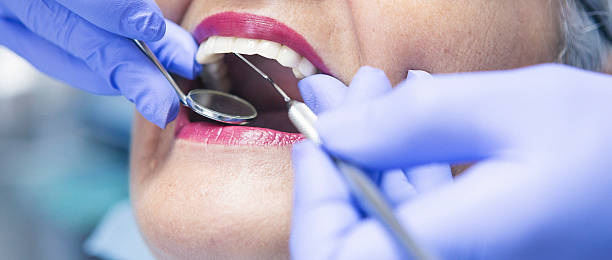 Best Knocked-Out Tooth Emergency  in Milliken, CO